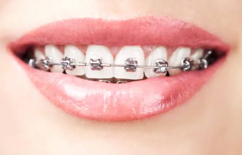 6 Smile Enhancement Tips From Dentists Who Combine Health And Aesthetics